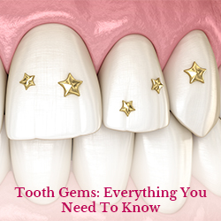 Tooth Gems
